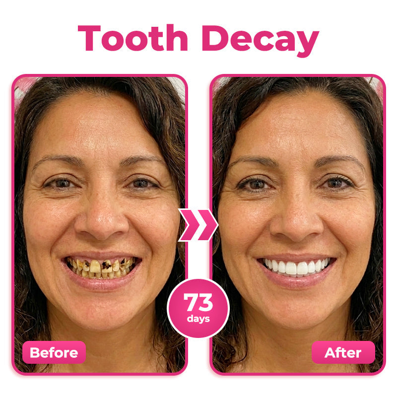 AQA™ Thismile NH-10 Enamel & Gum Advanced Therapy Toothpaste Serum